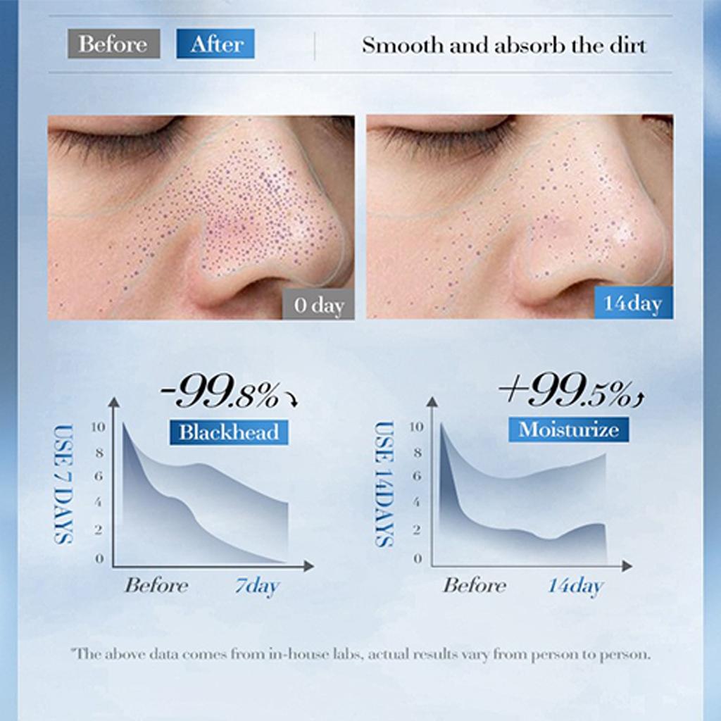 Blackhead Remover, Blackhead Nasal Mask Ointment, Improves Strawberry Nasal Oil And Nasal Mask