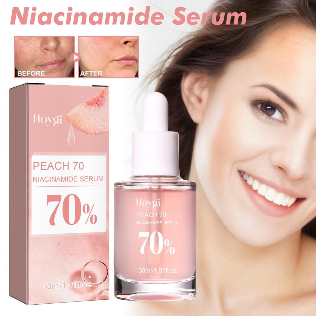 Hoygi Niacinamide Serum Firming & Hydrating Pores Fades Acne Marks & Fine Lines Brightens Skin & Reduces Dark Spots 30ml