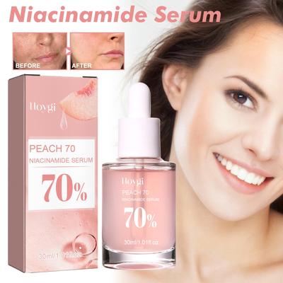 Sérum de Niacinamida Reafirmante e Hidratante Poros Desvanece Marcas de Acné y Líneas Finas Ilumina la Piel y Reduce las Manchas Oscuras 30ml