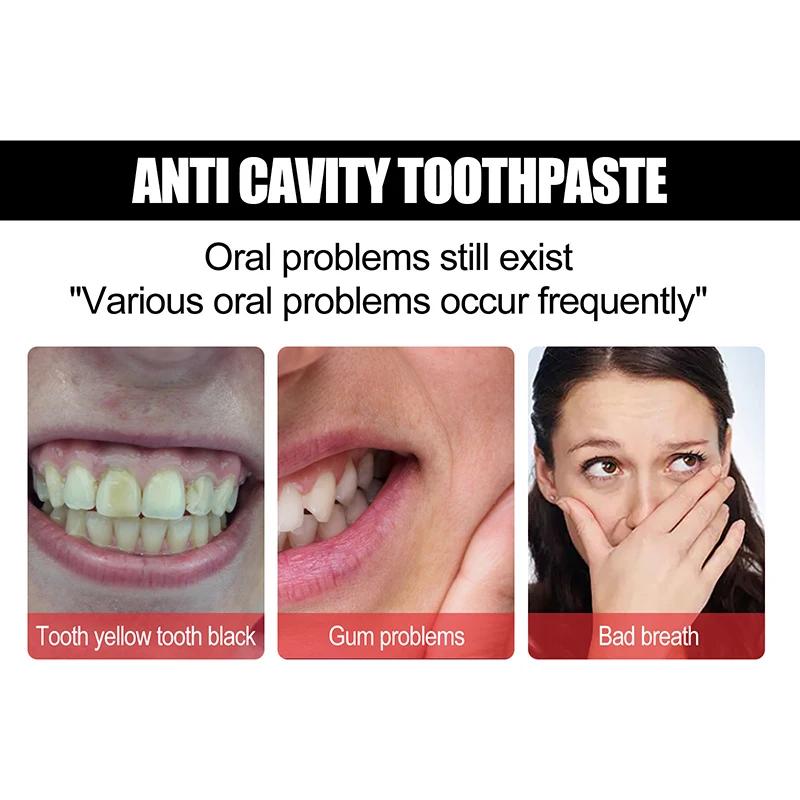 Blanchir les dents réparation dentifrice carie dentaire enlever la Plaque soulager la parodontite mal de dents élimination rafraîchit l'haleine soins des dents