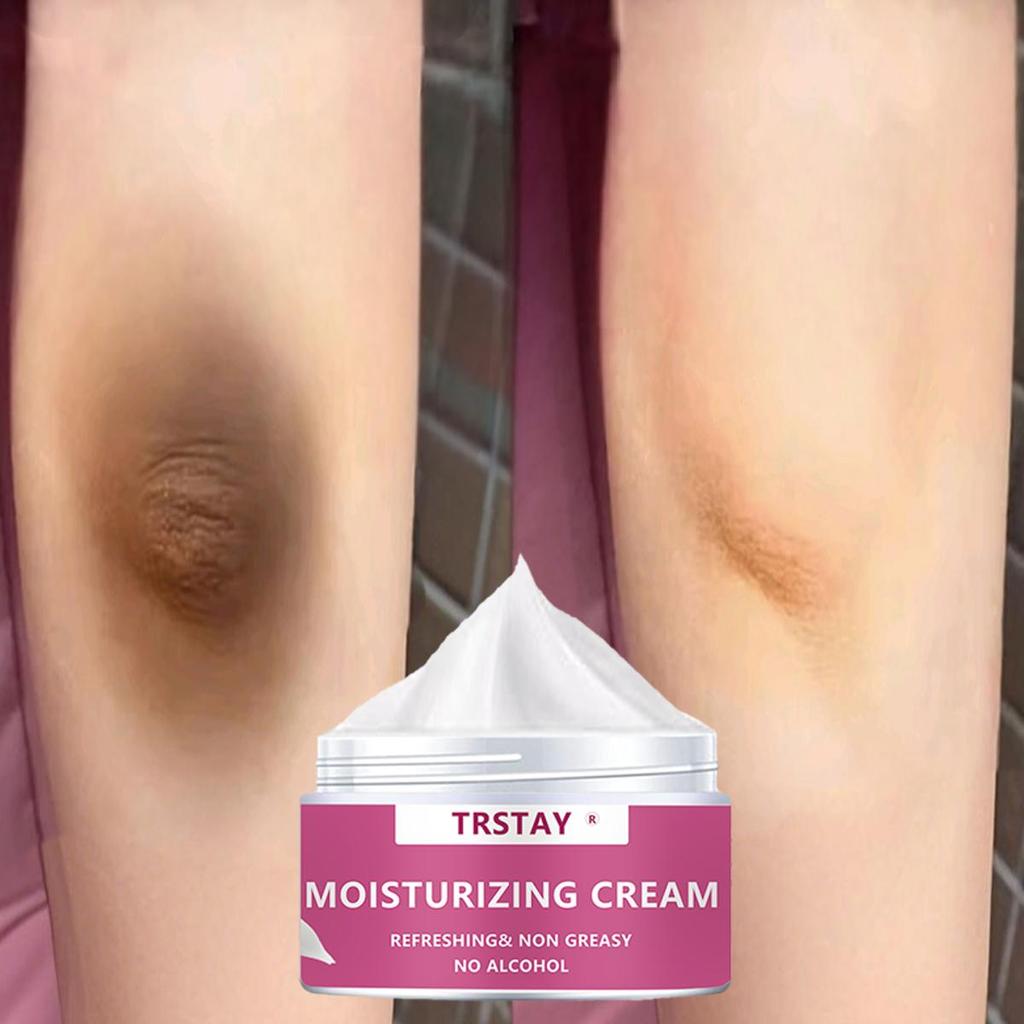 Whitening Body Whitening Cream Underarm Back Leg Knee Body Whitening Cream Moisturizing Repair Cream