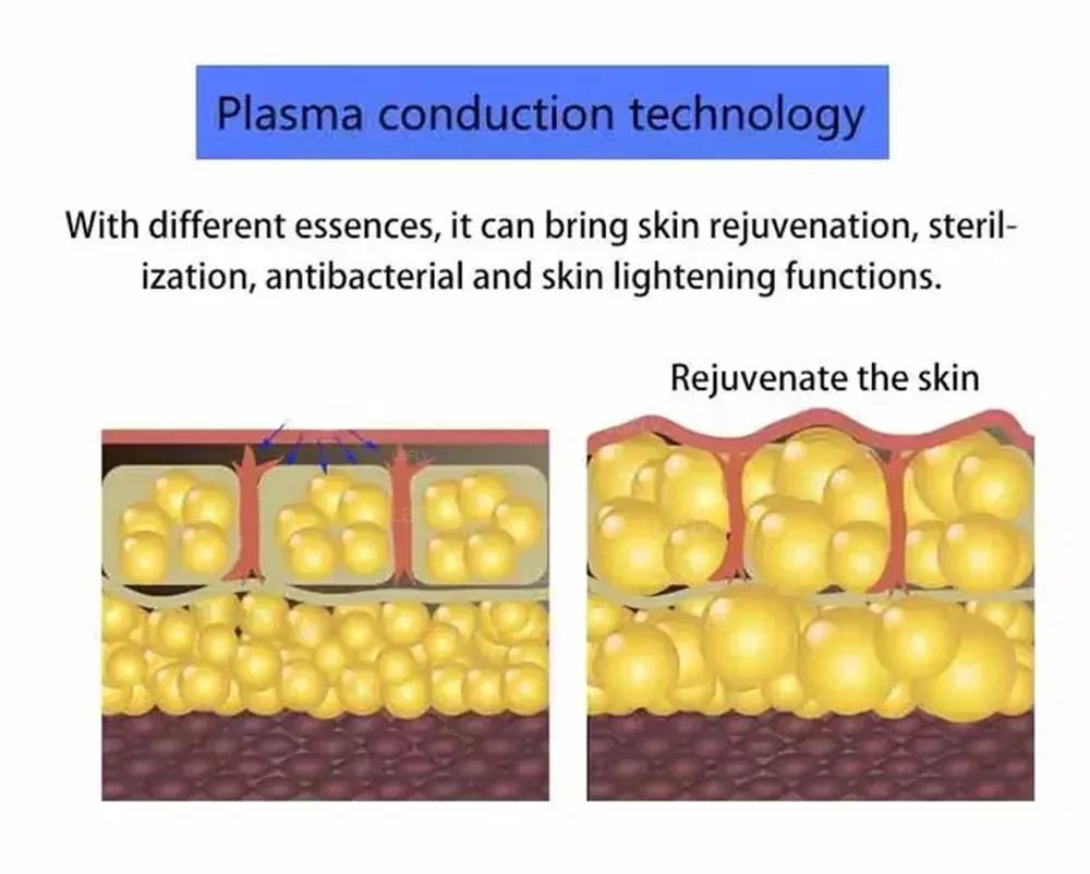 SPA Use Cold Plasma Pen Ozone Acne Remover Wrinkle Removal Skin Rejuvenation Sterilization Anti-inflammation Beauty Instrument
