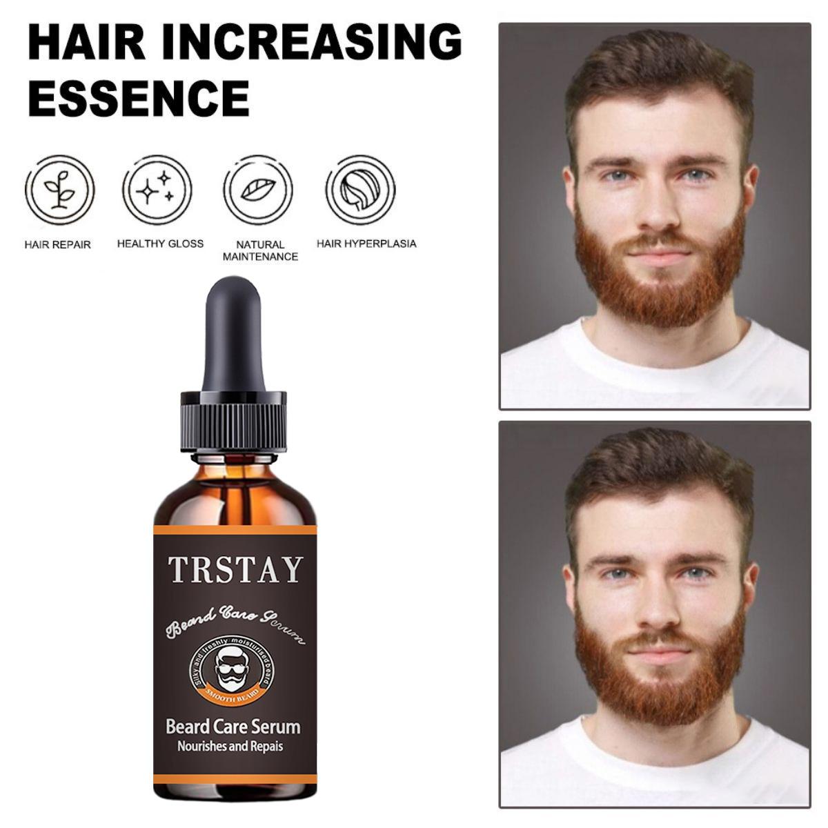 

Спрей для роста бороды, подмышек и волос более длинный и густой. «Будь настоящим мужчиной» легко использовать, а эффект очевиден.