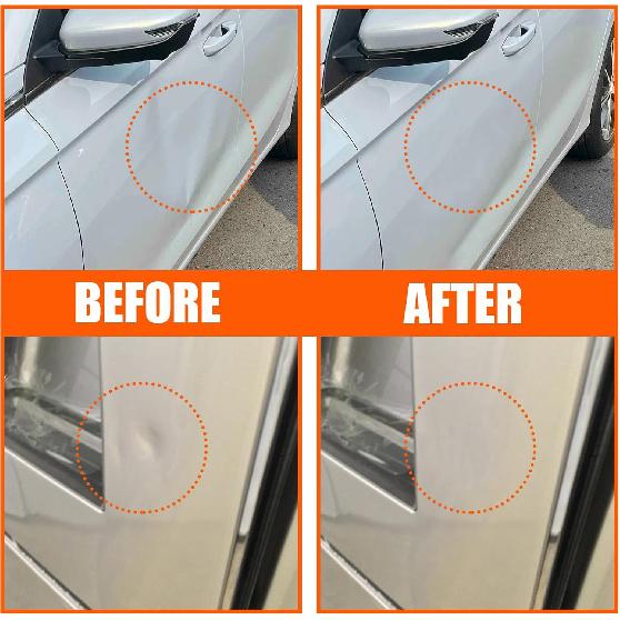 Dent Puller, 7 Pack Car Dent Puller Kit,Car Dent Remover Tool For Car,Paintless Dent Removal Kit,Hail Dent Removal Kit,Dent Puller Suction Cup For