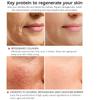 Sérum protéiné visage sérum Anti-rides Essence du visage blanchissant hydratant soins de la peau