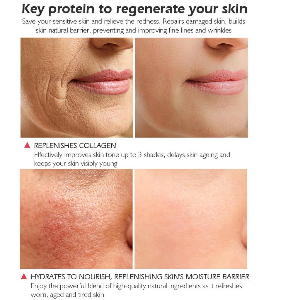Sérum protéiné visage sérum Anti-rides Essence du visage blanchissant hydratant soins de la peau