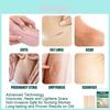 Eelhoe Silicone Gel Scar Patches For Effective Surgical Scar Reduction And Skin Healing