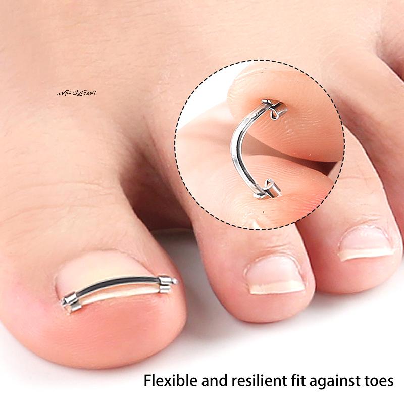 Curved Clamp Ingrown Toenail Pedicure Tool Toe Nail Care Straightening Correction Clip Embed Nail Care Tool for Toes