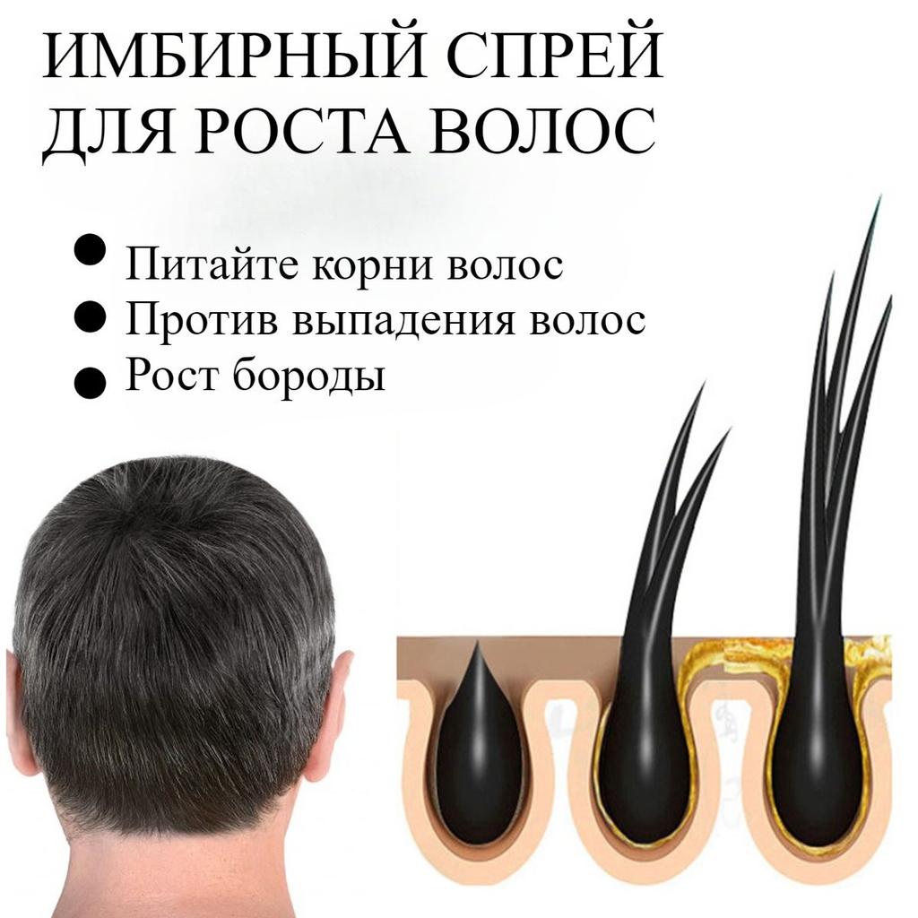 30ml Ginger Hair Growth Spray Scalp Nourishing Thick Hair Hair Care Nutrient Spray