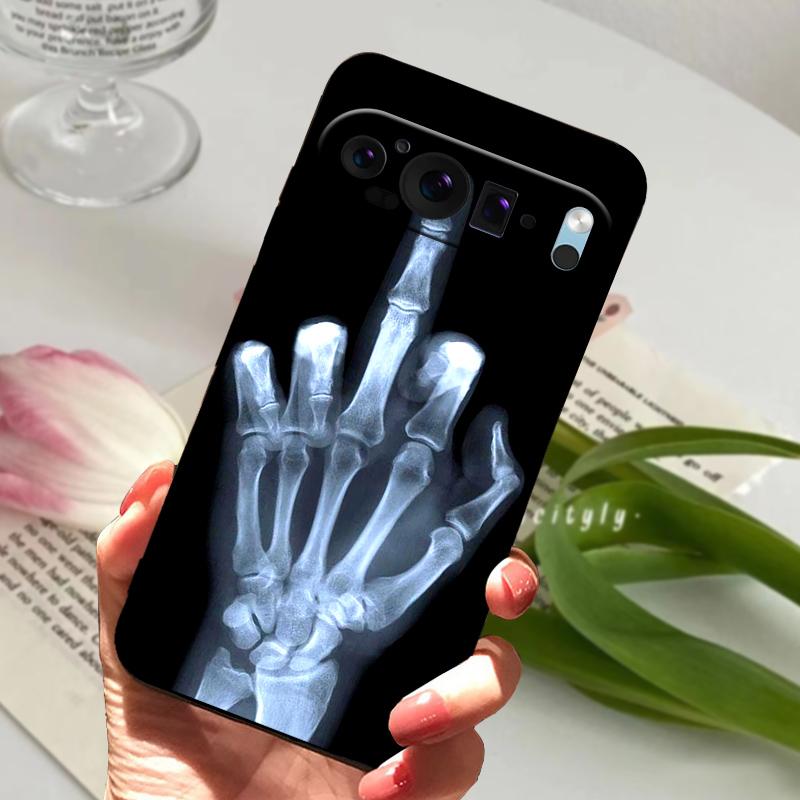 For Google Pixel 9 Pro Case Pixel9 Pro XL Cute Animal Soft Silicone TPU Phone Cover For Google Pixel 9 9a Bumper Fundas Luxury