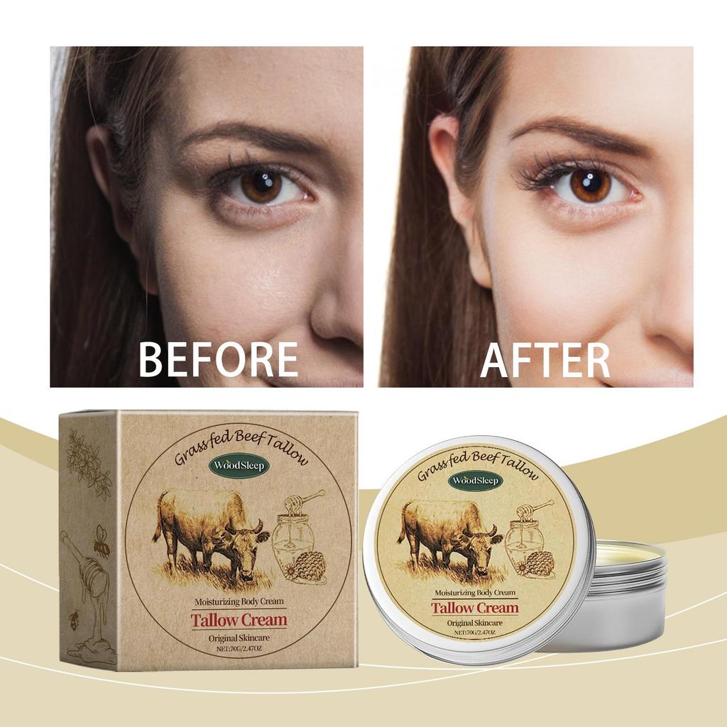 70g Beef Tallow Skin Cream Nourishing Moisturizing Hydration Dry Skin Soft Body Skin Moisturizer
