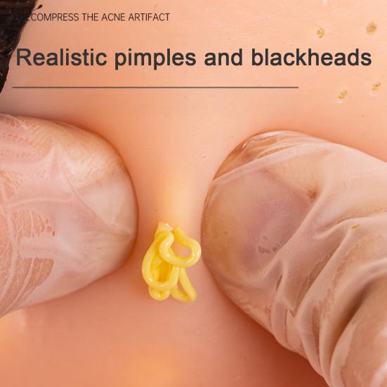 2 st Pormaskklämleksak Fyllning Fett DIY Stressavlastning Pormask Ansiktssimulator Silikon Akne Näsa Påfyllningsfett Tillbehör