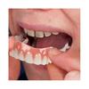 Extra Thin Fake Bright White Tooth Veneers Silicone Soft Safe Adhesive Denture Hide Shade Braces Comfortable Teeth Orthodontic