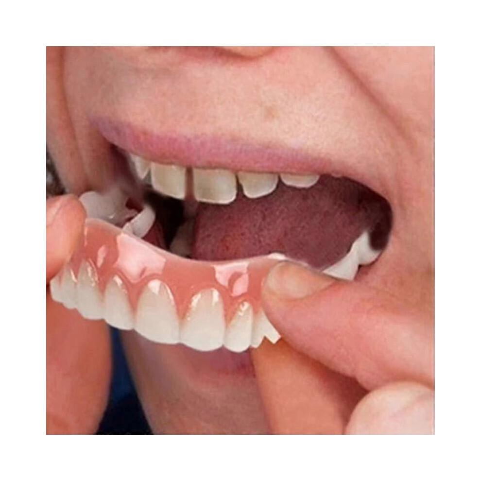 Extra Thin Fake Bright White Tooth Veneers Silicone Soft Safe Adhesive Denture Hide Shade Braces Comfortable Teeth Orthodontic