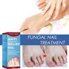 Nail Repair and Brightening Oil for Thickened and Ingrown Nails