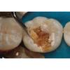 GDC Spoon Excavator Oval Shape #6 EXC19WH