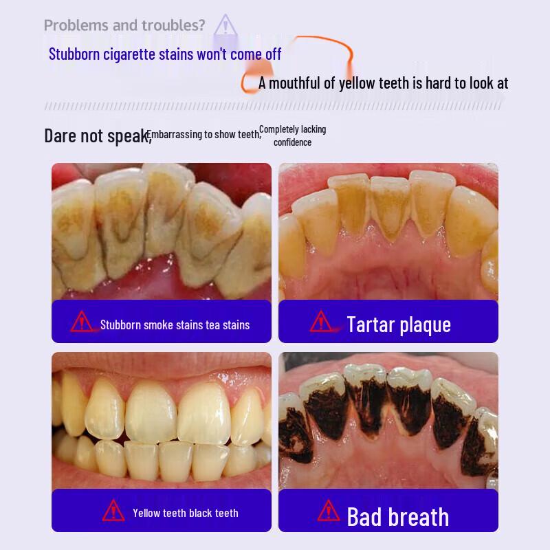 HIEUAILR Whitening & Stain Removal Toothpaste