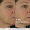 Tatcha The Dewy Skin Cream Aufpolsternde   Feuchtigkeitsspendende Feuchtigkeitscreme 1,7 Unzen