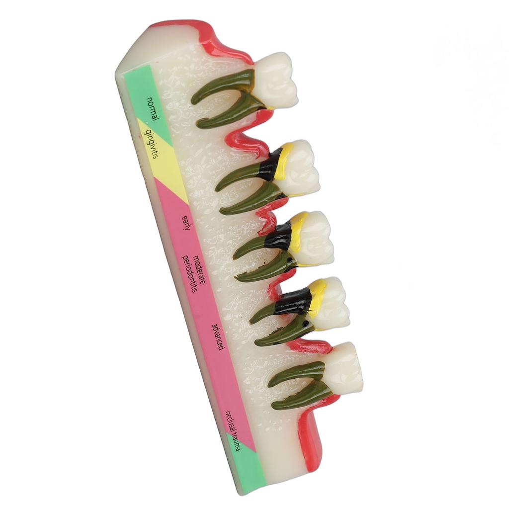 Dental Teeth Model Ceramic Clear Structure Oral Care Educational Periodontal Disease Model