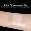10Pcs First Aid Bandage Waterproof Adhesive Wound Dressings Sterile Dressing Hemostasis Patch Sticker Surgical Sutures