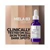 La Roche-Posay Mela B3 Anti-Pigmentfleck Serum 30ml