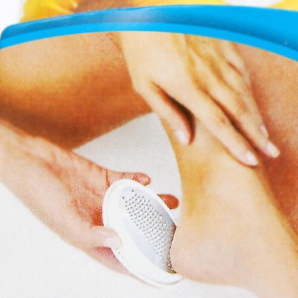 Egg Callus Remover/Foot Care Callus Remover
