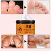 Foot Cream Heel Crack Repair Cream Dead Skin Removing Hand and Foot Care Moisturizing Cream