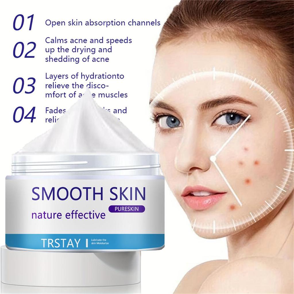 Whitening and Acne Removing Essence Cream, Brightening Facial Skin, Anti-oxidation and Anti-aging, Moisturizing Cream