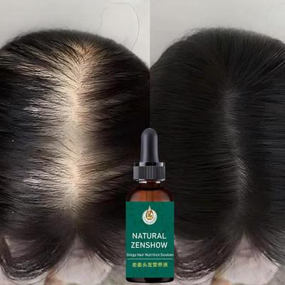 Fast Hair Growth Essential Oil Repair Hair Follicles Treatment Hair Loss Regrowth Hair Ginger Essence Healthier Hair