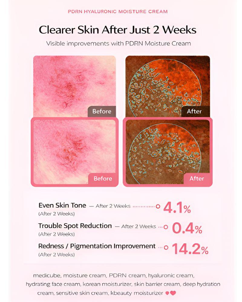 Medicube PDRN Hyaluronic Moisture Cream