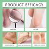 Lifesparking 7 Day Feet Callus Remover, 7 Day Ginger Foot Spray, Foot Ginger Nourishing Spray, Instant Feet Exfoliating Serum, Moisturizing & Smooth