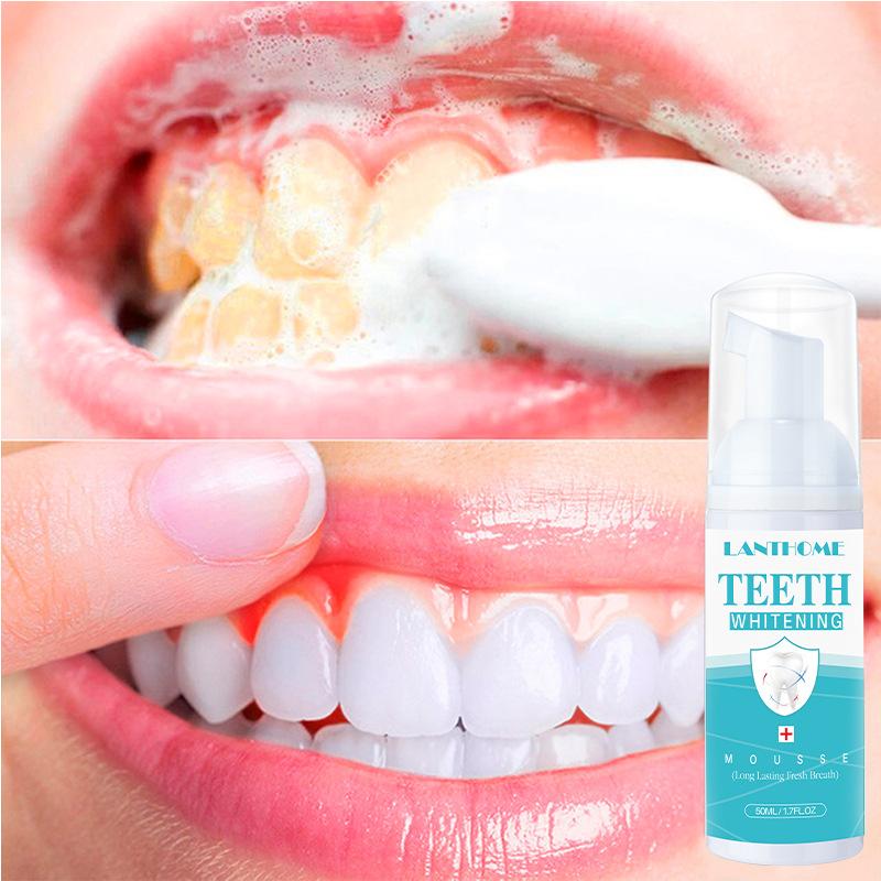Lanthome Teeth Whitening Foam Dental Cleaning Mousse Fresh Breath Stain Remover Portable