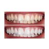 Teeth Cleaning Whitening Cream, Gentle and Non-irritating, Deeply Cleans Teeth and Makes Teeth Whiter