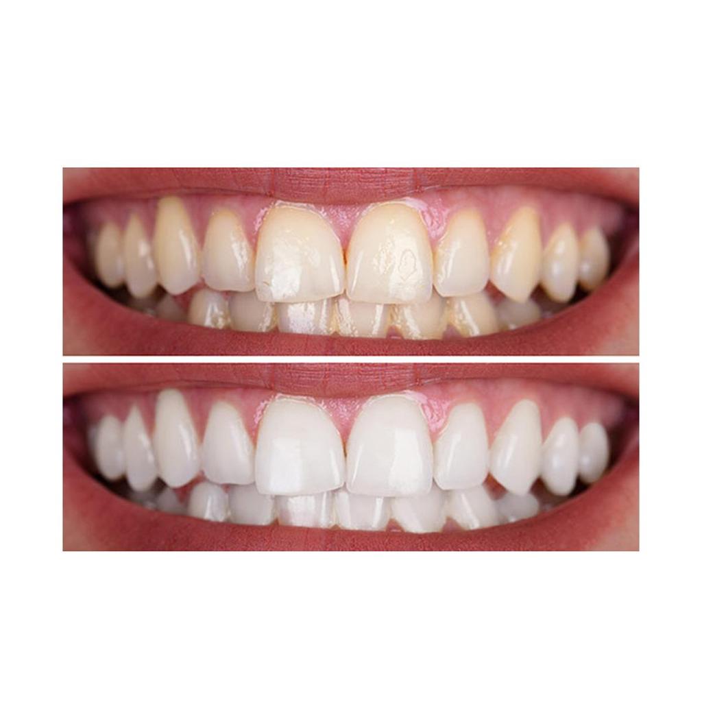 Bělící krém na čištění zubů, jemný a nedráždivý, hloubkově čistí zuby a činí zuby bělejšími