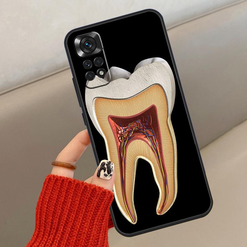 

Human Tooth Anatomy Case For Xiaomi Redmi Note 14 13 12 10 11 15 Pro Plus Cover For Redmi 15 15C 13C 10C 12C 14C Redmi Note 14 Pro 5G