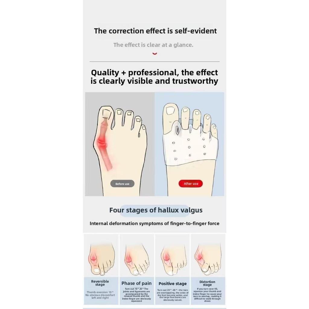 2 stuks Teenspreider Gemaakt van Silicagel met Hallux Valgus Brace-Comfortabel Voetuitlijningshulpmiddel Om het Effect van Fittnesstraining te Verbeteren