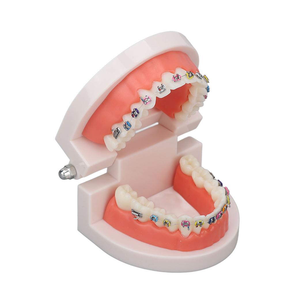 Dental Typodont Teeth Model with Orthodontic Metal Bracket for Dentist Teaching Research Dental