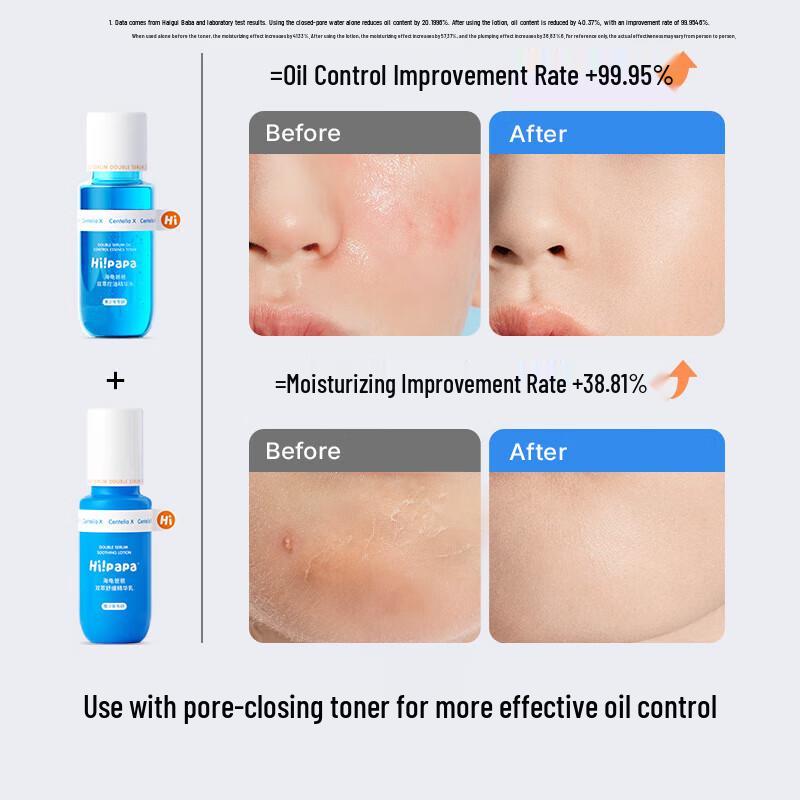 Hi!papa Teen Oil Control Skincare Set