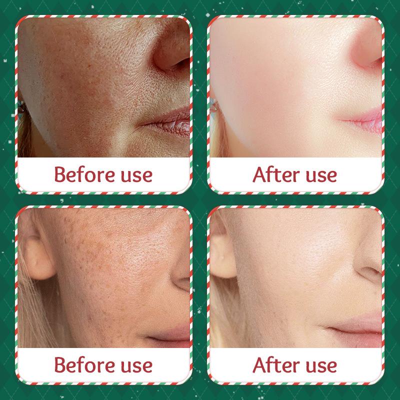 Sadoer Christmas Mask Series Whitening Facial Mask Hydrating Mask