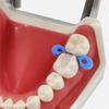 20 szt./60 szt./120 szt. Matryce stomatologiczne profilowane sekcyjne Matryce Matrix Bands Tofflemire Stuck materiał do laboratorium dentystycznego S/M/L