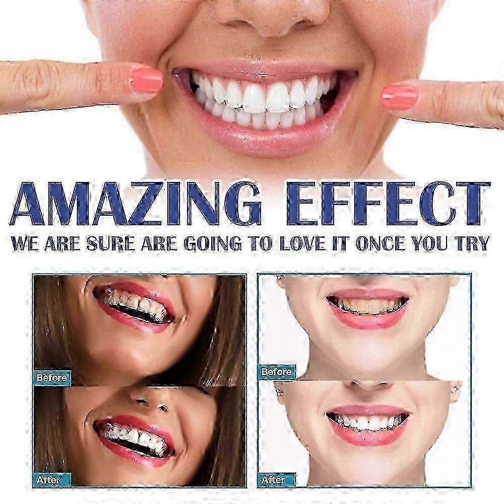 3 Pezzi Gel Terapia Gengivale, Gel Lenitivo Istantaneo per Denti Sensibili e Cura delle Gengive