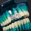 Bling Ready Stock Hip Hop Double Rose Heart Cubic Zirconia Grillz Brass Micro Pave Iced Out Teeth Jewelry  Tooth Decor