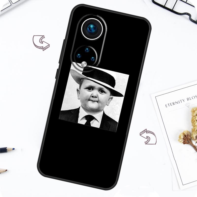 Funny Hasbulla Case For Honor Magic 7 5 6 Lite Honor 200 Pro X8b X9a X8a X8 X9 X9c X9b 50 70 90 Lite Cover