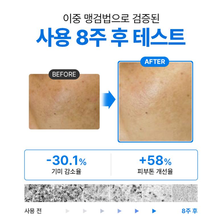 [Skin MD] Pure Whitenoll Intensive Cream 15ml (Improves Dark Spots and Blemishes)