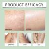 Ximonth Facial and Body Hair Removal Strips for Smooth Skin