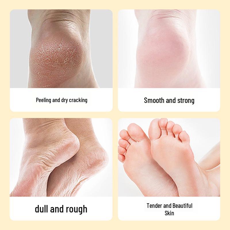 BIOAQUA Peeling Fußcreme: Tiefenreinigende, feuchtigkeitsspendende und hydratisierende Formel für rissige und trockene Füße.