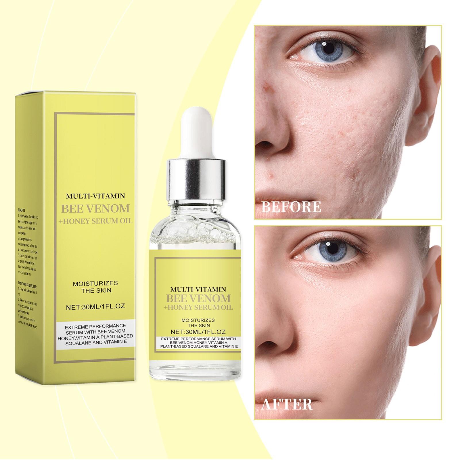

Honey Serum Oil, Moisturizing And Moisturizing Skin Care Refreshing Serum Rejuvenating Skin Serum Oil 30ml