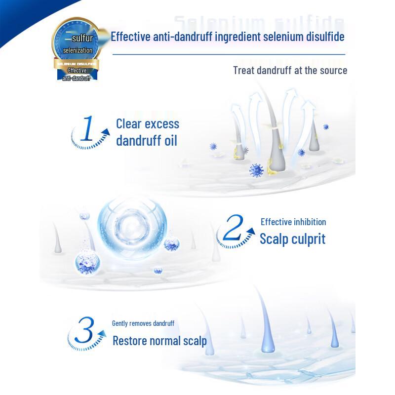 Mentholatum Refreshing Anti-Dandruff Shampoo