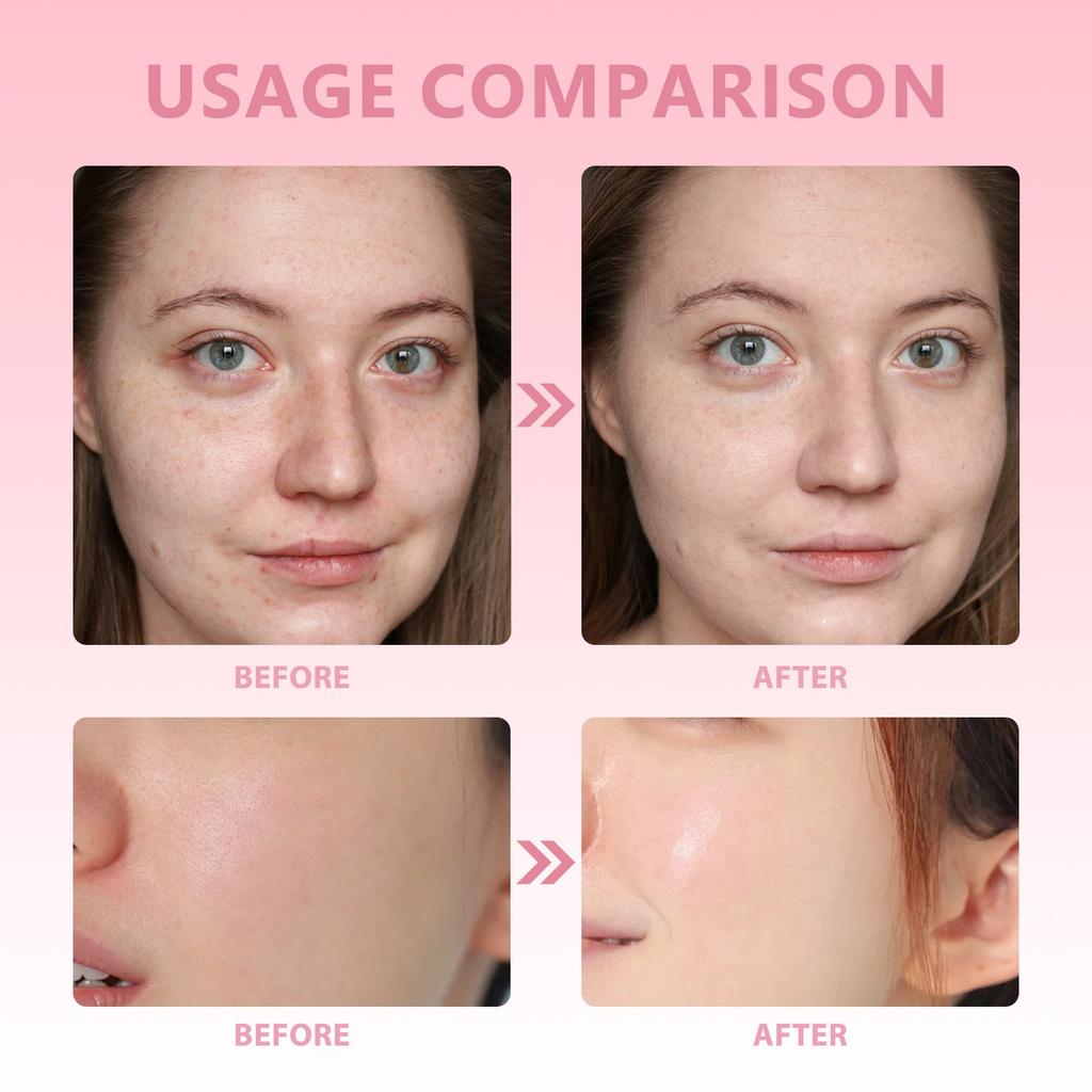 Brightening Cleansing Pads Kojic Cleansing Pads Helps Balance Skin Oil And Water Hydrating Remove Excess Keratin From The Body'S Skin30PC1ml