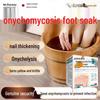Onychomycosis Treatment Foot Soak Pack